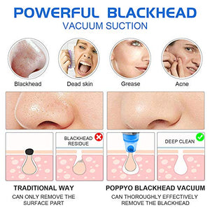 See why this the POPPYO Blackhead Remover Pore Vacuum is blowing up on TikTok.   #TikTokMadeMeBuyIt 
